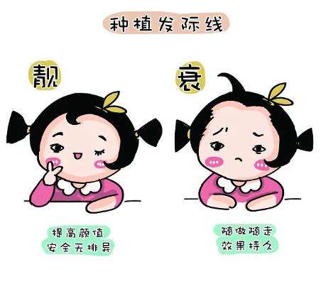 发际线种植1.jpg