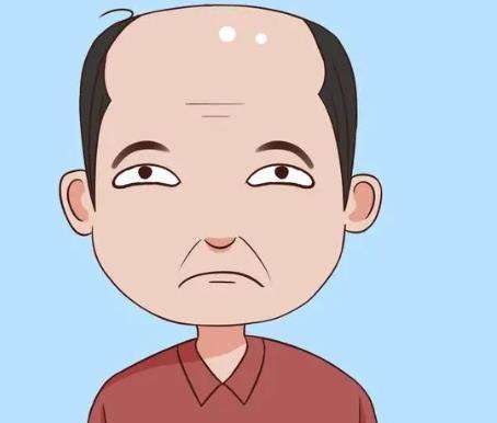 男性的发际线高1.jpg