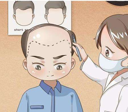 发际线4.jpg