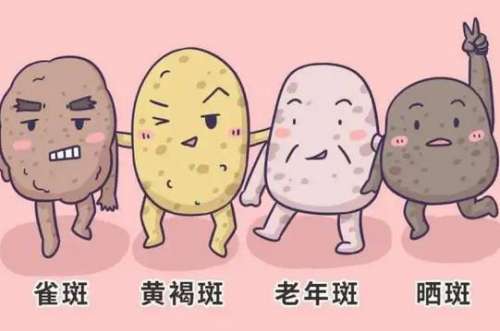 激光祛斑的原理是什么，注意事项有哪些