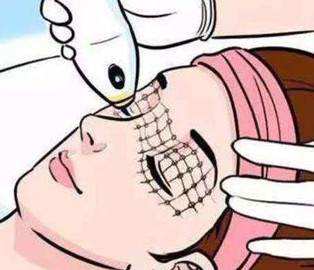 热玛吉2.jpg