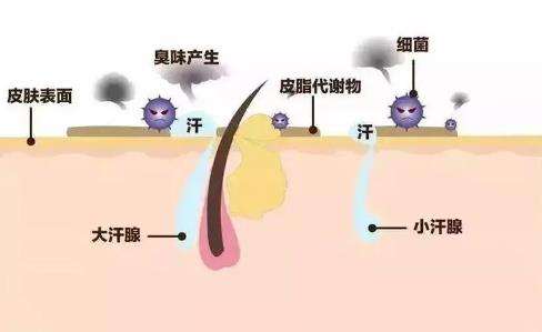 狐臭和腋臭有什么区别?会不会遗传?