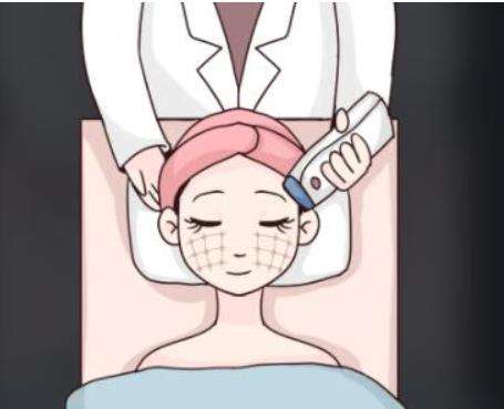 热玛吉3.jpg