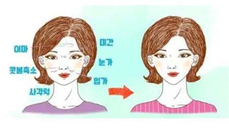 电波拉皮除皱效果如何?