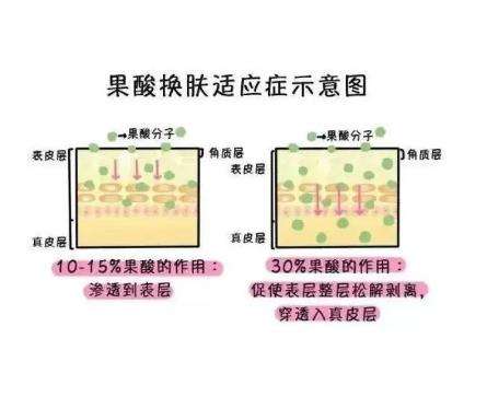 需要多久进行一次果酸换肤