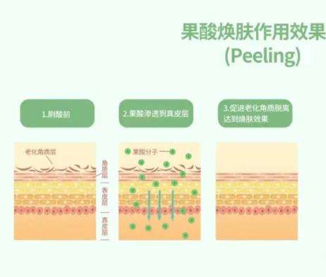 果酸换肤.jpg