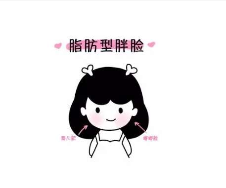 面部吸脂1.jpg
