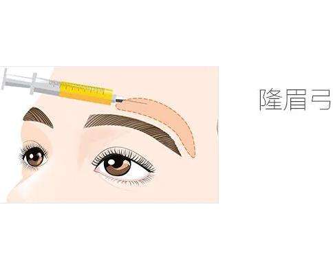 隆眉弓.jpg