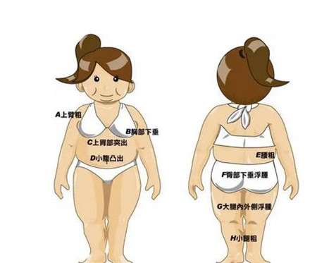 大腿环吸的特点有哪些，注意事项有哪些