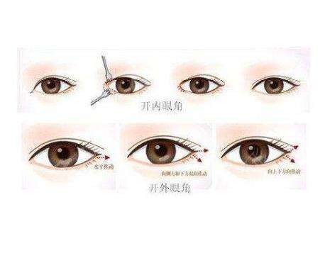 开眼角1.jpg