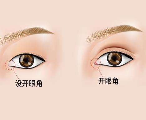 开眼角4.jpg