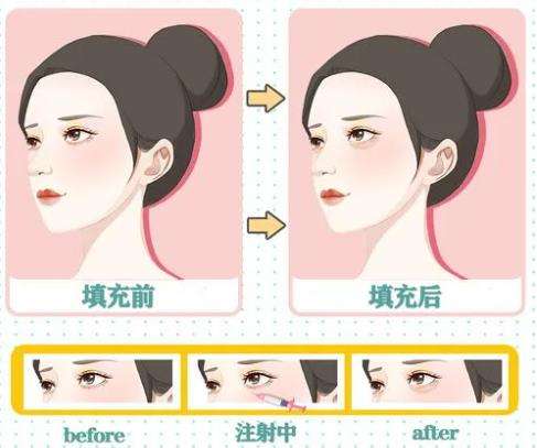 卧蚕.jpg