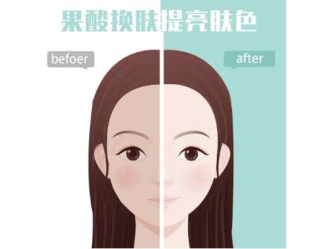 果酸换肤8.jpg