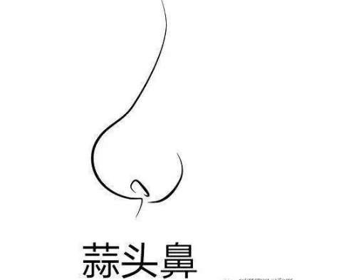 矫正大蒜鼻.jpg