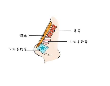 进口膨体1.jpg