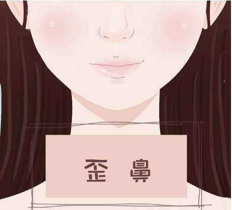 鼻骨矫正.jpg