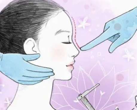 达拉斯鼻整形术.jpg