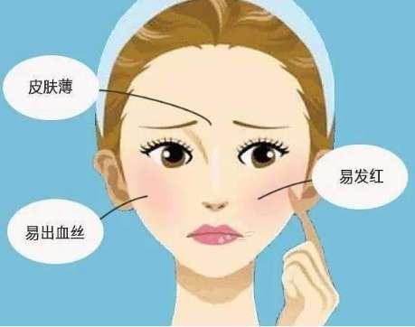 激光去除红血丝7.jpg