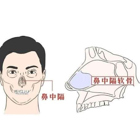 鼻中隔偏曲3.jpg