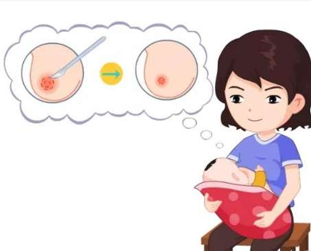 乳晕缩小手术效果怎么样，适合什么年龄