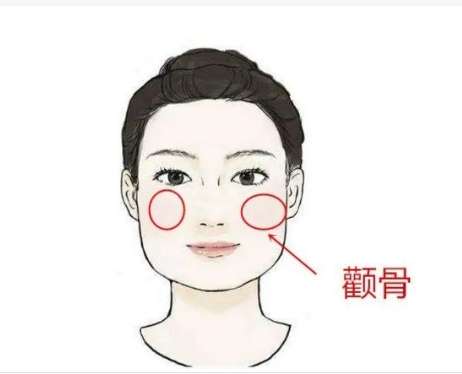 颧骨缩小术4.jpg