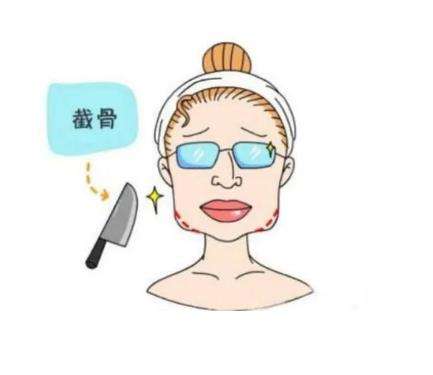 下颌角截骨手术.jpg
