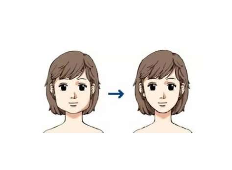 面部吸脂3.jpg