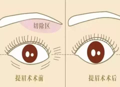 切眉6.jpg
