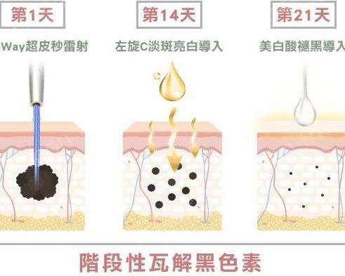 蜂巢皮秒3.jpg