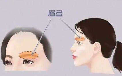 什么是切眉，常见的方法有哪些