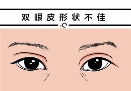 双眼皮手术需要多长时间