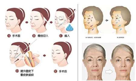 微信截图_20220417193630.jpg