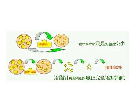 溶脂针4.jpg